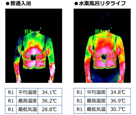 effect_thermography01